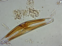 Cymbella