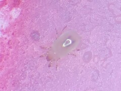 Acaridae