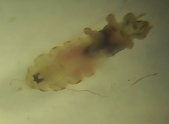 Pediculus humanus capitis