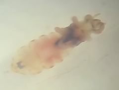 Pediculus humanus capitis