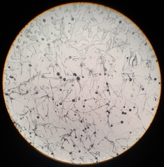 Aspergillus