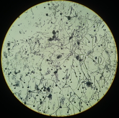 Aspergillus