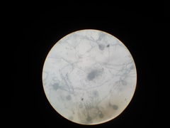 Aspergillus