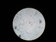 Aspergillus