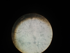 Aspergillus