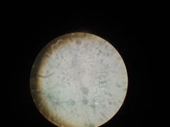 Aspergillus