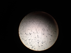 Aspergillus