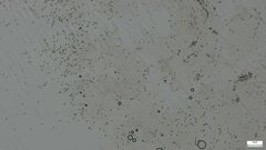 Boletus nigromaculatus