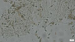 Boletus nigromaculatus