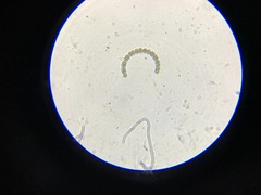 Anabaena
