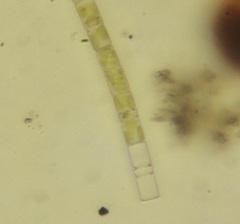 Aulacoseira ambigua