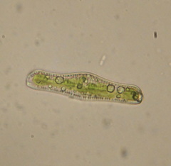 Epithemia gibba