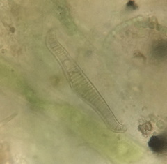 Epithemia gibba