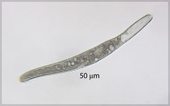 Spirostomum teres