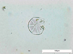 Asteromphalus