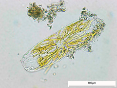 Tropidoneis