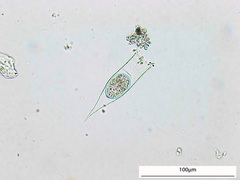 Eutintinnus