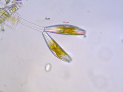 Cymbella