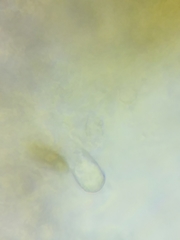 Steccherinum nitidum