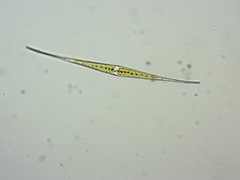 Closterium kuetzingii