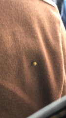 Psyllobora vigintiduopunctata