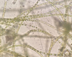 Microspora