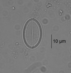 Cocconeis placentula