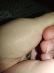 Pechipogo plumigeralis