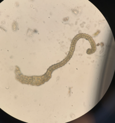 Racomitrium brevipes