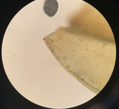 Racomitrium brevipes