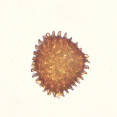 Fossombronia wondraczekii