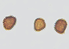 Fossombronia wondraczekii