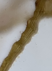 Vertebrata