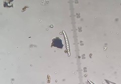 Cresponea plurilocularis