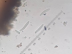 Cresponea plurilocularis