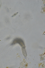 Chaetonotida
