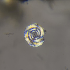 Cornuspira involvens