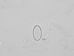 Cocconeis