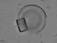 Stephanodiscus reimeri