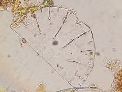 Micrasterias thomasiana