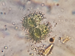 Staurastrum polytrichum