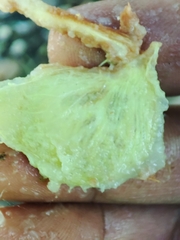 Garcinia