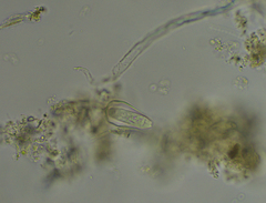 Cothurniopsis valvata