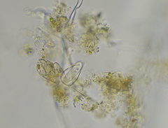 Cothurniopsis valvata