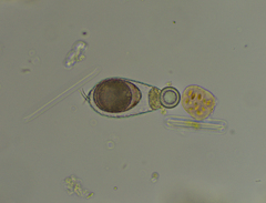 Euglypha