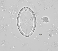Cocconeis