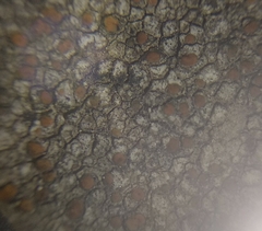 Protoblastenia rupestris