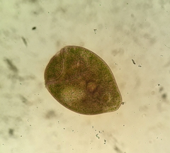 Stentor amethystinus