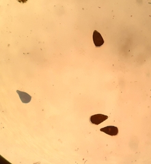 Stentor amethystinus