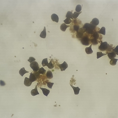 Stentor amethystinus